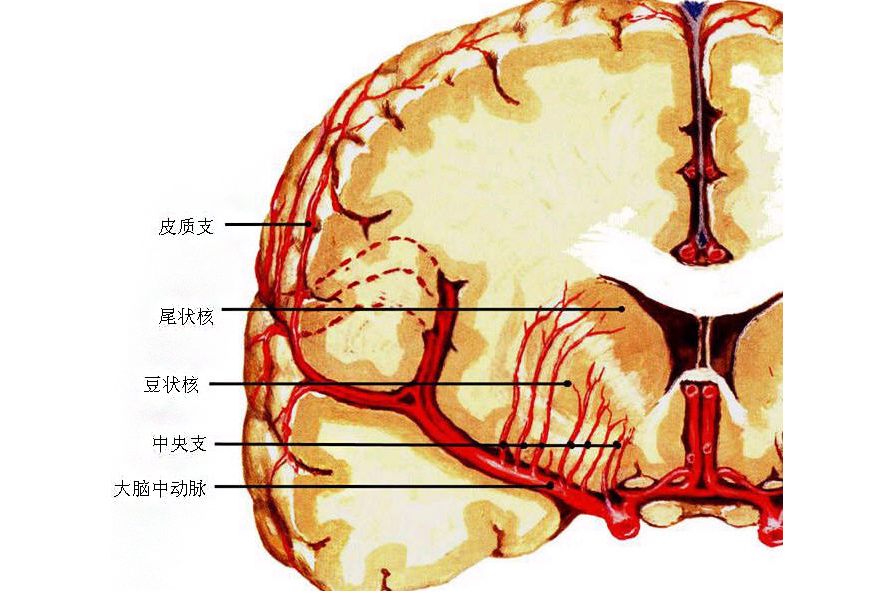 脑血管痉挛的症状