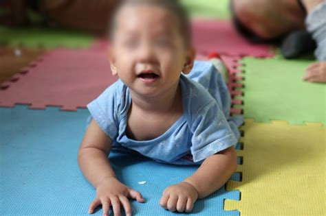 幼儿脑瘫是什么原因？