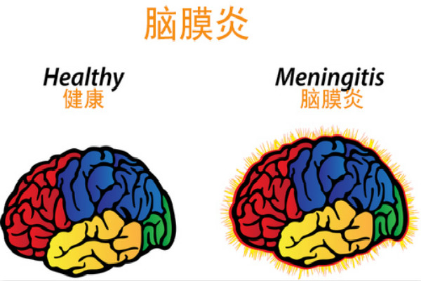 病毒性脑炎症状是什么？